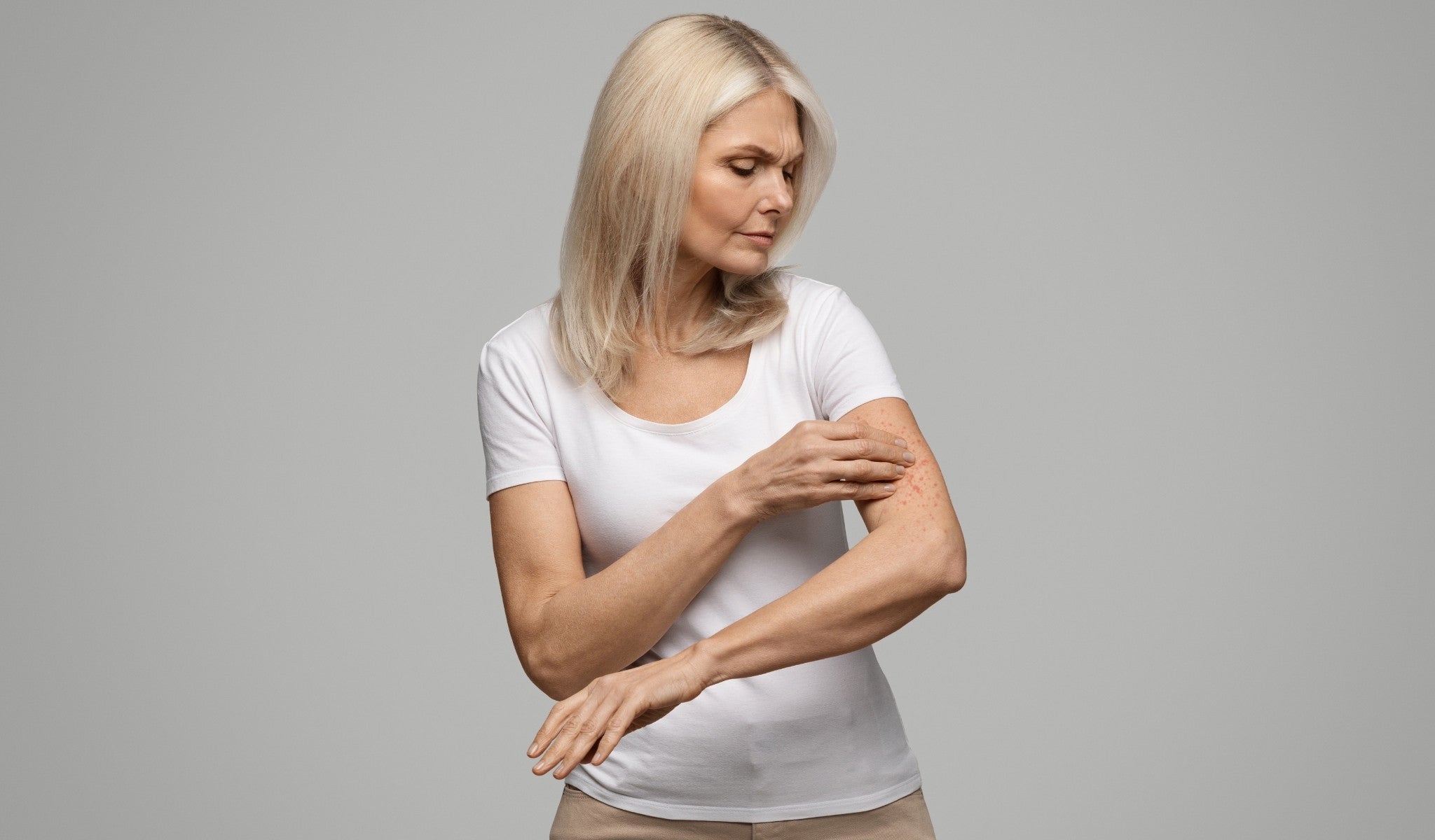 How to Choose the Right Skincare for Eczema