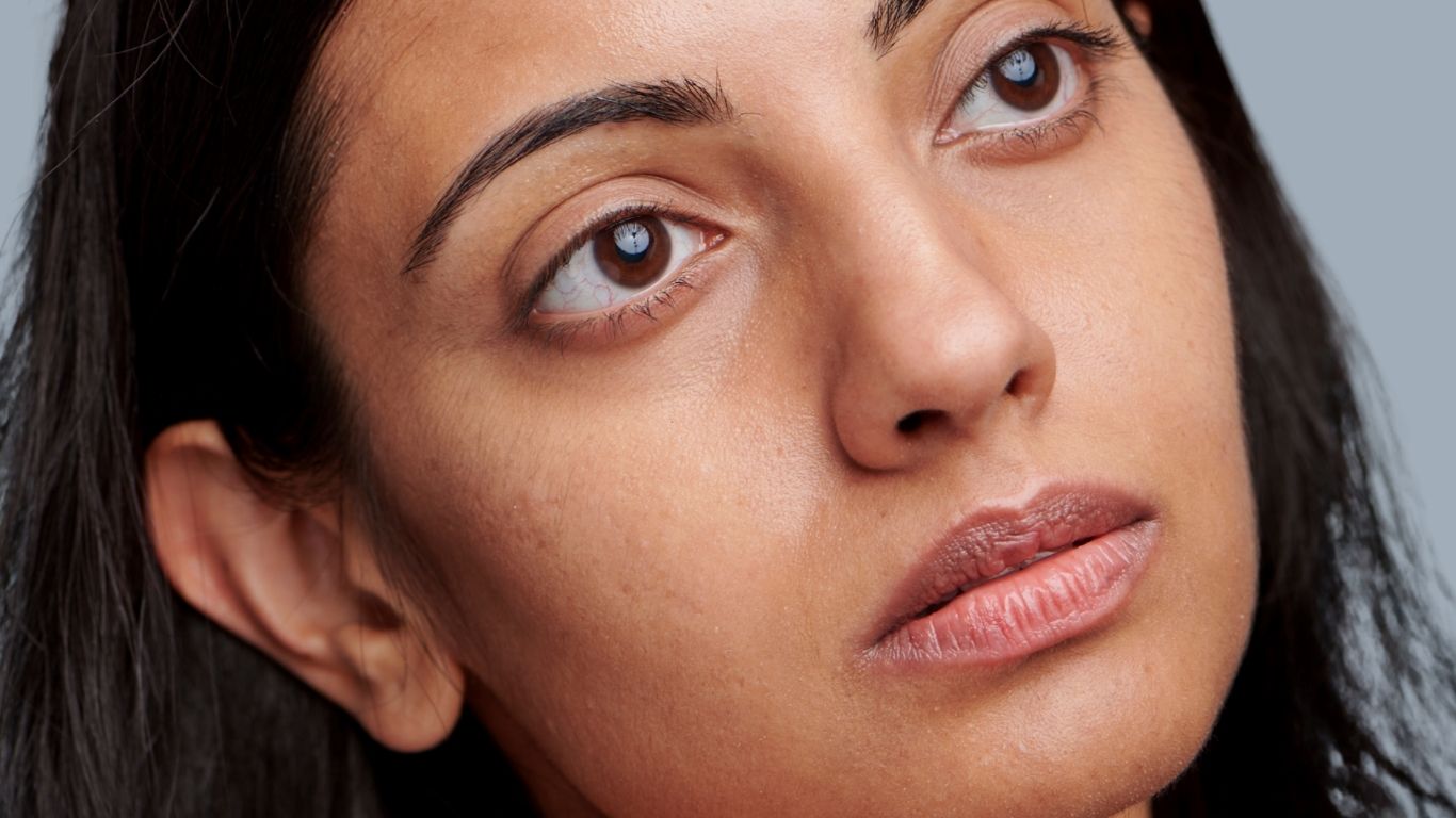 The Best Natural Solutions for Healing Scars  