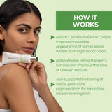 KS Cream for Visibly Smoother-Looking Skin After Scars or Stretch Marks